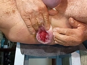 扩肛侠2025-14 delighted amatuer chinese porn