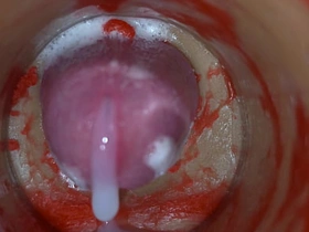 内射实录——体内镜头捕捉男性深喉射精 korean gay anime porn